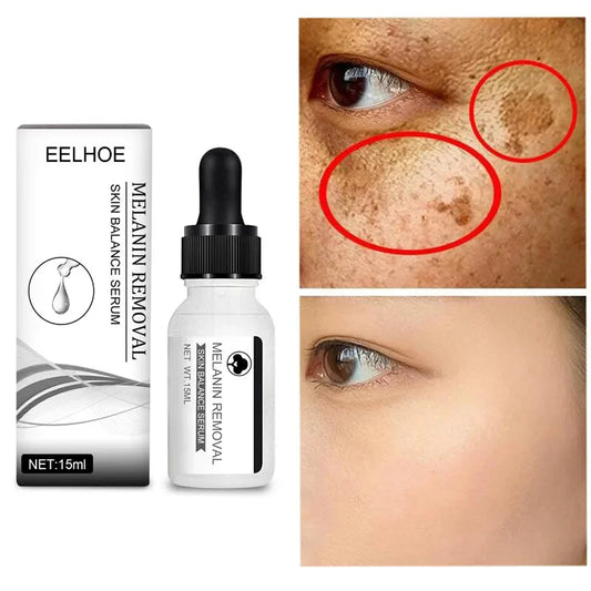 Niacinamide Serum Remove Dark Spots Freckle Whitening  Face Skin Care Cream
